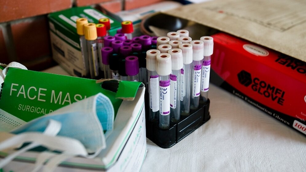 Tuberkulose_Molekuele_im_Blut_MPG_J_Steengard_24032016.jpg Moleküle im Blut