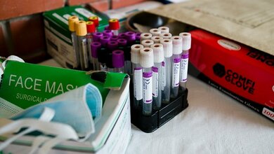 Tuberkulose_Molekuele_im_Blut_MPG_J_Steengard_24032016.jpg Moleküle im Blut