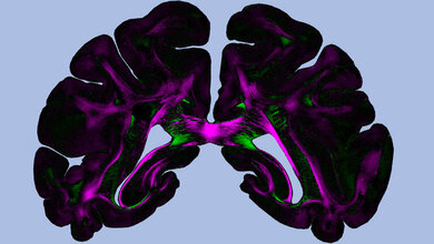Diattenuation_Imaging_DI_Miriam_Menzel_et_al_Scientific_Reports_2019.jpg „Diattenuation Imaging“ (DI)