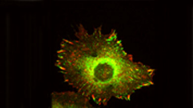 Zellmigration_-_Cadherin-11_gibt_den_richtigen_Halt_Kashef_KIT_300616.jpg Cadherin-11