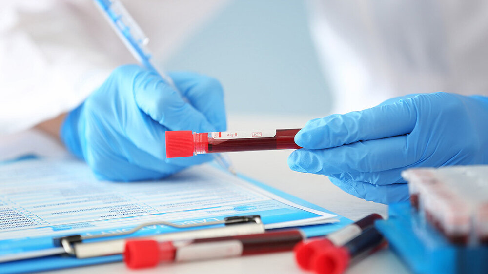 Blutprobe_Notizen.jpg Nahaufnahme von Händen in blauen Handschuhen, die eine Blutprobe in einem Röhrchen halten, mit medizinischen Unterlagen und weiteren Proben im Hintergrund.