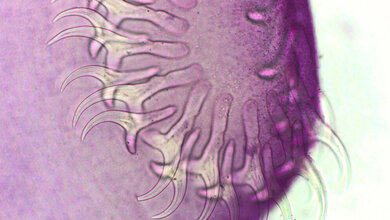 Gefaerbter_Kopf_doppelter_Hakenkranz_Bandwurm_Taenia_species_Leibniz_IZW_Lesniak.jpg Bandwurm Taenia species