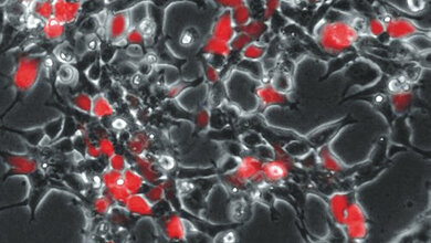 Menschliche_HEK293_Zellen_Kai_Boeker.jpg Menschliche HEK293-Zellen