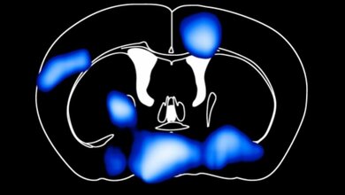 Querschnitt_durchs_Mausgehirn_MPI_fuer_Stoffwechselforschung_28042016.jpg Querschnitt durchs Mausgehirn