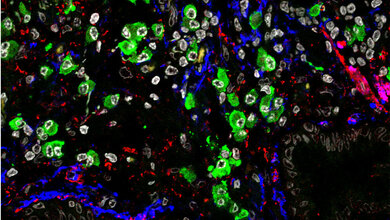 Mikroskopische_Aufnahme_von_vernarbtem_Lungengewebe_HZM_Herbert_Schiller.jpg Mikroskopische Aufnahme von vernarbtem Lungengewebe