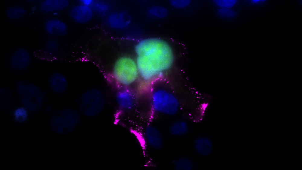 RSV_F-Protein.png Fluoreszenzmikroskopische Aufnahme von Zellen mit blau gefärbten Zellkernen, grünem Zellinhalt und pinken Strukturen.