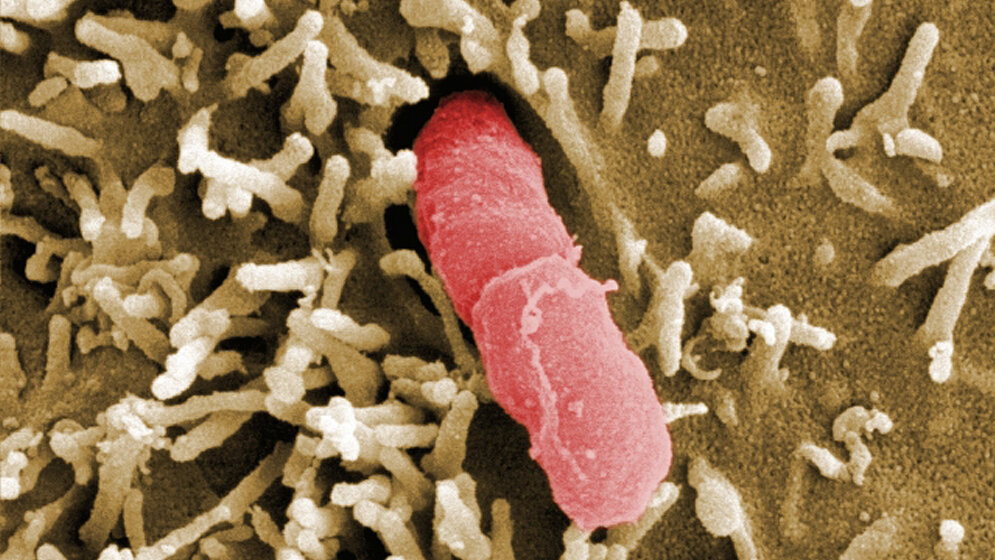 Elektronenmikroskopische_Aufnahme_Yersinia_pseudotuberculosis_HZI_Manfred_Rohde.jpg Yersinia pseudotuberculosis