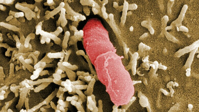 Elektronenmikroskopische_Aufnahme_Yersinia_pseudotuberculosis_HZI_Manfred_Rohde.jpg Yersinia pseudotuberculosis