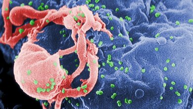 HIV_gruen_Lymphozyt_Von_C_Goldsmith_et_al._CDC_20042016.jpg HI-Viren (grün), Lymphozyt