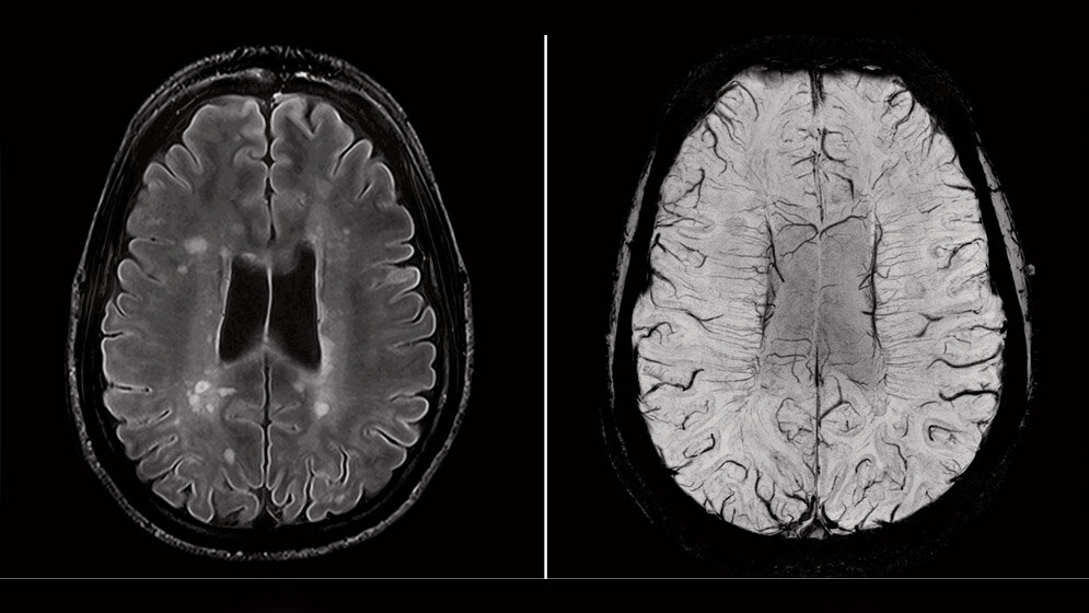 7_Tesla.jpg 7-Tesla-Aufnahmen