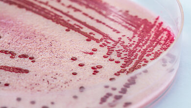 Listerien.jpg Listerien