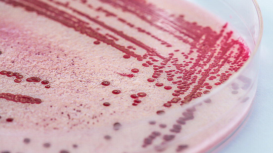 Listerien.jpg Listerien