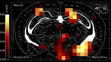 Querschnitt_durchs_Mausgehirn_MPI_fuer_Stoffwechselforschung_31032016.jpg Querschnitt durchs Mausgehirn