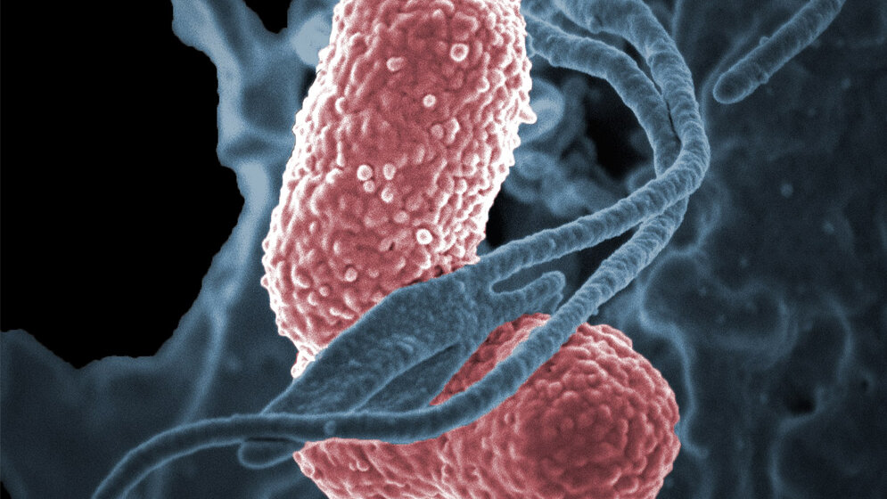Klebsiella_pneumoniae_unter_dem_Elektronenmikroskop_NIAID_Wikimedia.jpg Klebsiella pneumoniae