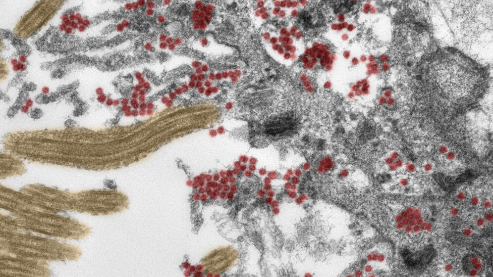 Ausschnitt_einer_Zelle_in_der_Riechschleimhaut_Charite.jpg Ausschnitt einer Zelle in der Riechschleimhaut.