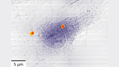 Zwei_Ansammlungen_von_Antibiotika_beladenen_Eisen_Nanocontainern_rot_Bild_Stachnik_et_al_Scientific_Reports_CC_BY_4_0.jpg Zwei Ansammlungen von Antibiotika-beladenen Eisen-Nanocontainern