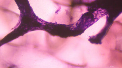 Eingefaerbte_Zellkultur_lila_auf_dem_neu_entwickelten_3D_Silkongitter_Dr_Peggy_Stock.jpg Eingefärbte Zellkultur (lila) auf dem neu entwickelten 3D-Silkongitter