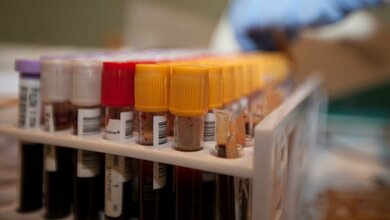 Blutspende_von_LCpl_Austin_Schlosser_Public_domain_via_Wikimedia_Commons_30032016.jpg Blutspende