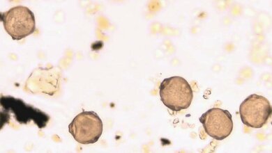 Mikroskopisch_kleines_Aergernis_Birkenpollen_in_Nahaufnahme_Foto_UNIKA-T_11052016.jpg Birkenpollen