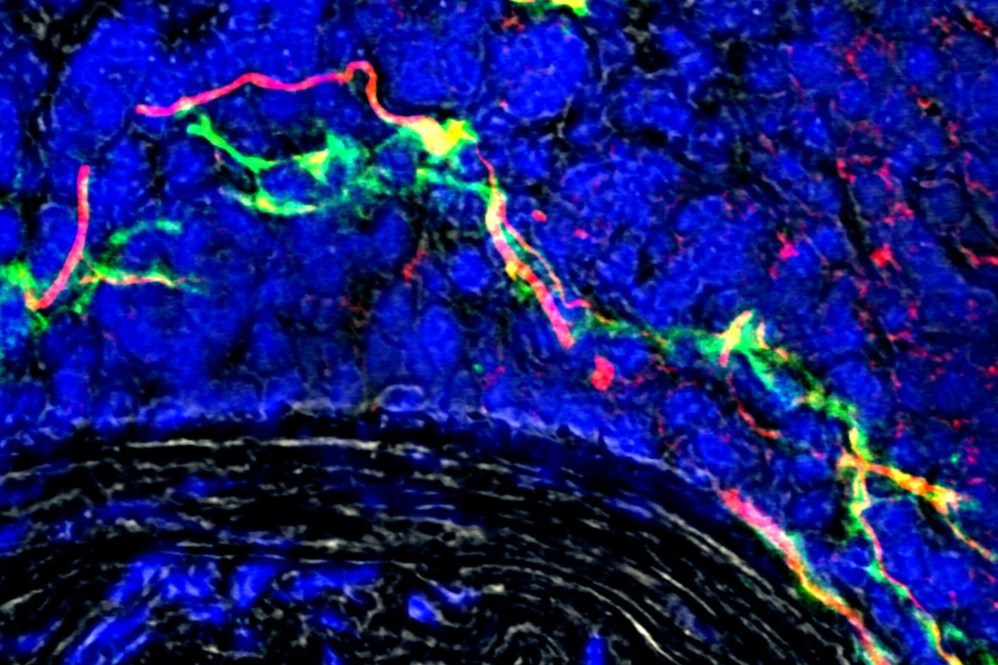 Wachsendes_Nervennetzwerk_gruen_in_betroffener_Arterie_LMU.jpg Wachsendes Nervennetzwerk (grün)