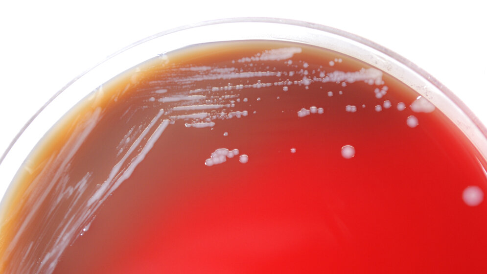 Burkholderia_mallei_auf_Blutagar_CDC_Dr_Todd_Parker_Audra_Marsh_public_domain.jpg Burkholderia mallei