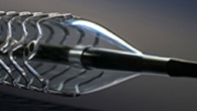 mg_20stent.jpg Stents