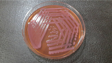 Acitenobacter_baumanii_Agar.jpg Acinetobacter baumannii