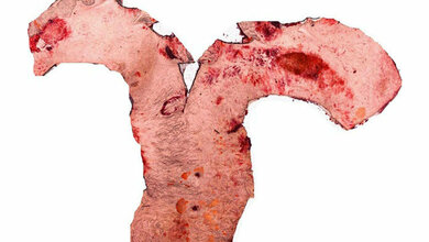 Bild_von_einer_fixierten_Aorta_Quelle_Helmholtz_Zentrum_Muenchen_Niopek.jpg Bild von einer fixierten Aorta