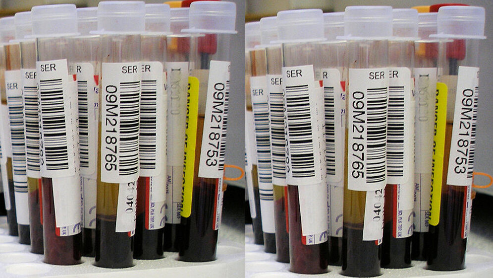 Liquid_Biopsy_Photograph_by_Graham_Beards_CC_BY_SA_3_0_Wikimedia_Commons_21092016.jpg Liquid Biopsy