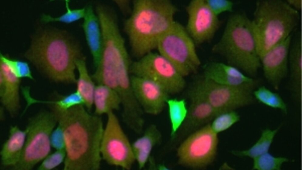 Neuroblastom_Zellen_Quelle_Pruszak_lab_22032016.jpg Neuroblastom-Zellen.
