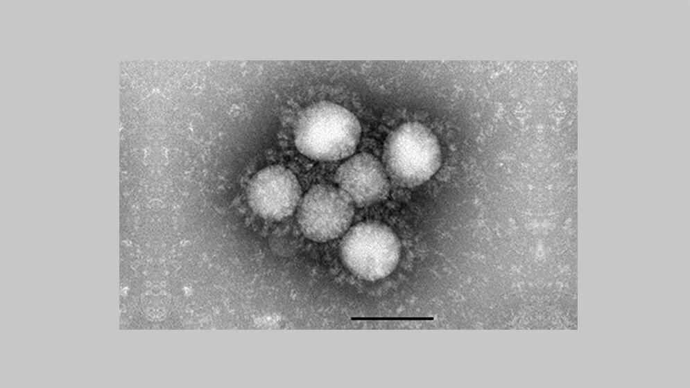 coronavirus_RKI.jpg Coronavirus (2019-nCoV)
