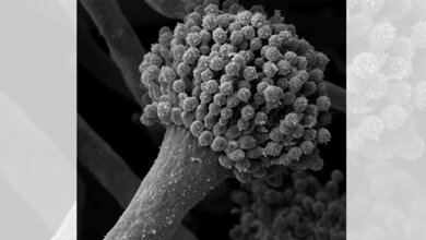 Elektronenmikroskopische_Aufnahme_des_Schimmelpilzes_Aspergillus_fumigatus_HKI.jpg Aspergillus fumigatus