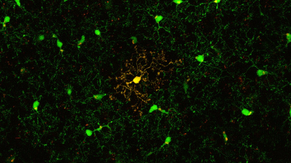 newsimage291712.jpg Mikrogliazelle