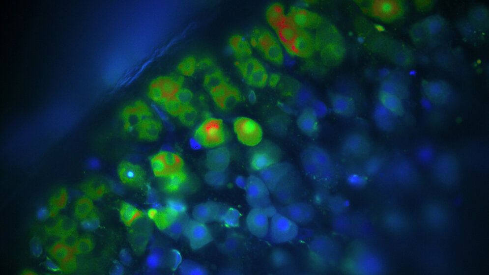 Kalzium_Messungen_von_Aldosteron_produzierenden_Zellen_der_Nebenniere_Audrey_H_Soria.jpg Kalzium-Messungen von Aldosteron-produzierenden Zellen