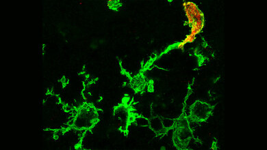 Mikroskopisches_Bild_von_gruen_angefaerbten_Makrophagen_nach_einem_Schlaganfall_AG_Stumm_UKJ.jpg Mikroskopisches Bild von grün angefärbten Makrophagen