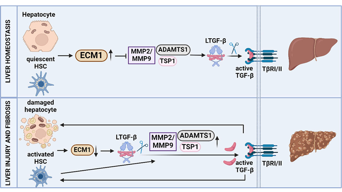 Leberfibrose_ECM1.jpg Leberfibrose