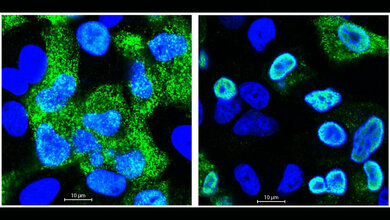 Mikroskopische_Aufnahme_menschlicher_Zellen_nach_Infektion_mit_Grippeviren_Foto_AG_Selbach_MDC.jpg Mikroskopische Aufnahme menschlicher Zellen nach Infektion mit Grippeviren