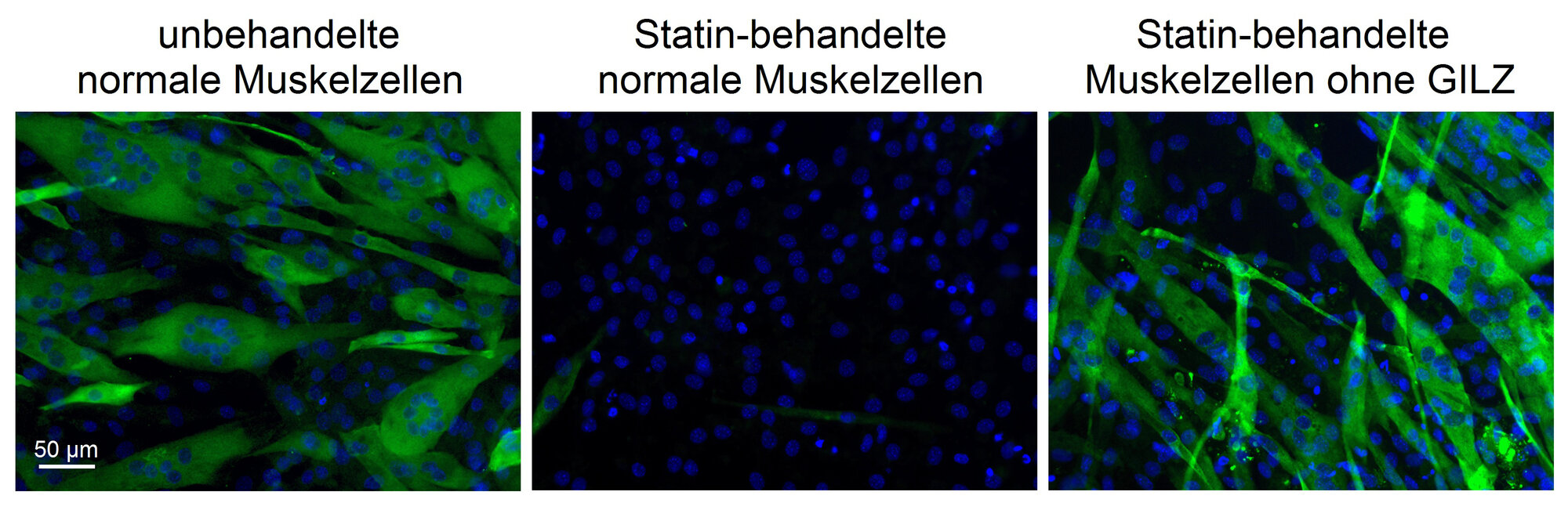 Statin.jpg Muskelfasern nach Statin-Behandlung