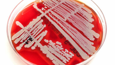 Bakterienkultur_Staphylococcus_aureus_Paediatrische_Infektiologie_UK_Bonn_19082016.jpg Bakterienkultur von Staphylococcus aureus