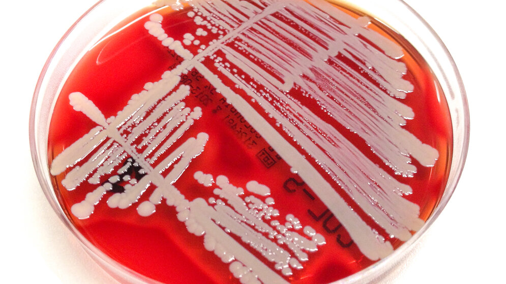 Bakterienkultur_Staphylococcus_aureus_Paediatrische_Infektiologie_UK_Bonn_19082016.jpg Bakterienkultur von Staphylococcus aureus