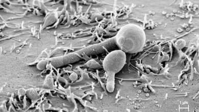 Candida_albicans_hat_Hyphe_gebildet_Toxin_Candidalysin_Holland_Oezel_Zak_02052016.jpg Candida albicans