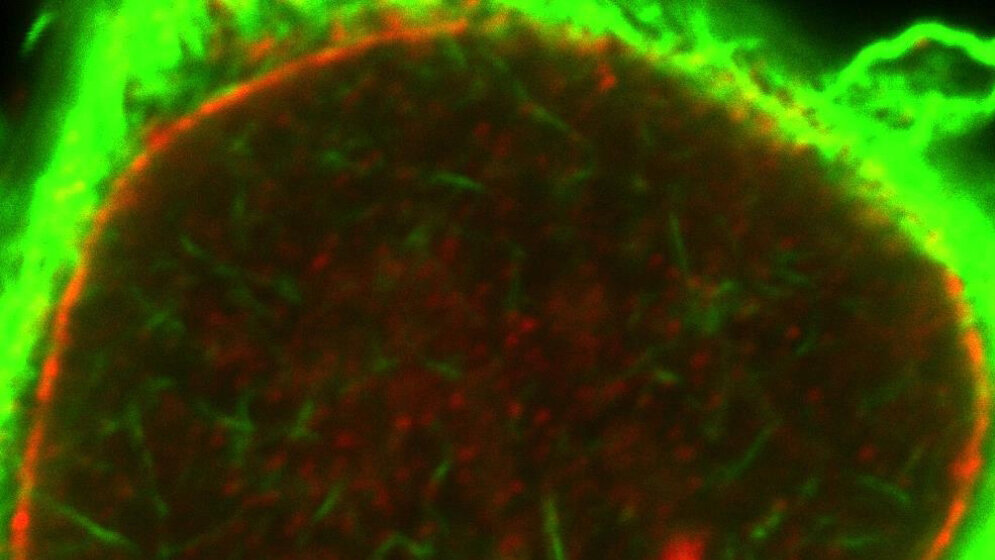 Im_Zellkern_findet_sich_Netzwerk_aus_Aktin_gruen_gefaerbt_AG_Grosse_Philipps_Universitaet_Marburg_02052016.jpg Netzwerk aus Aktin