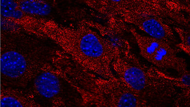 Zellen_einer_Maus_mit_menschlichem_MxA_Protein_MxA_rot_Zellkerne_blau_Deeg_et_al_2017.jpg Zellen einer Maus mit menschlichem MxA-Protein