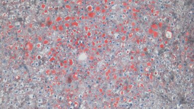 Fettfaerbung_in_der_Leber_Quelle_Helmholtz_Zentrum_Muenchen_10052016.jpg Fettfärbung in der Leber