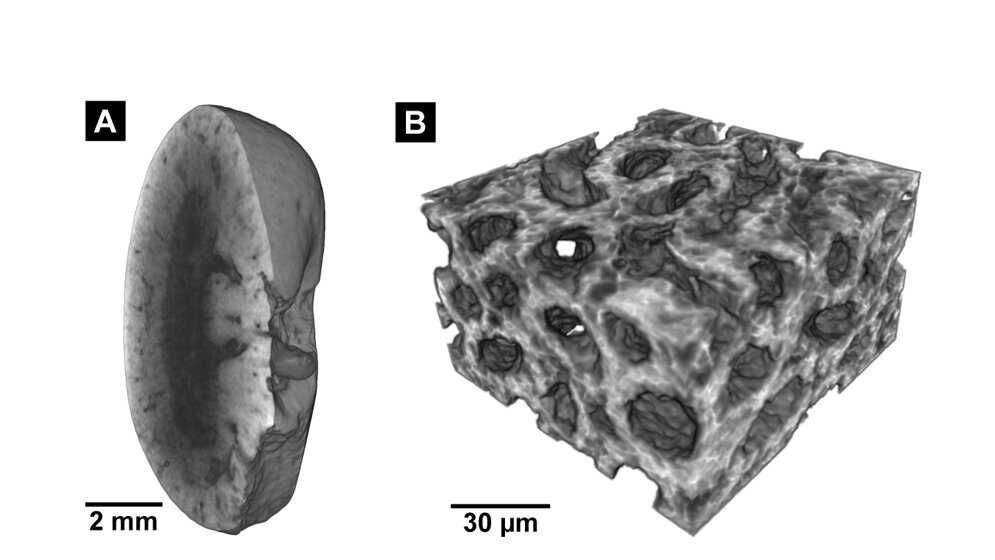 Neue_Faerbemethode_Müller_Pfeiffer_TUM_PNAS.jpg Neue Färbemethode