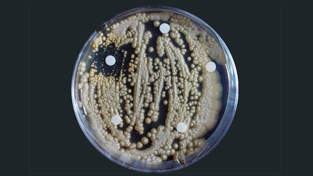 Pilz_Apiotrichum-porosum.jpg Petrischale vor schwarzem Hintergrund mit Ausstrichen eines Pilzes