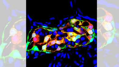 Podozyten_sitzen_auf_der_Kapillare_und_wandern_nichtFoto_Florian_Siegerist.jpg Podozyten