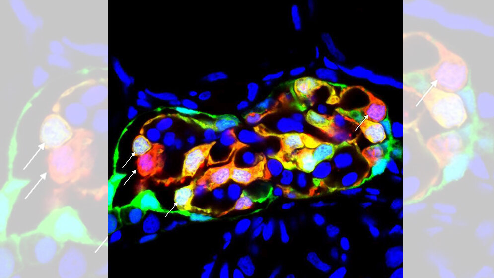 Podozyten_sitzen_auf_der_Kapillare_und_wandern_nichtFoto_Florian_Siegerist.jpg Podozyten