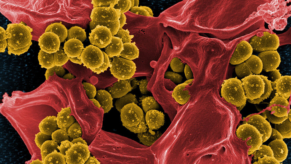 Staphylococcus_NIAID_public_domain.jpg MRSA