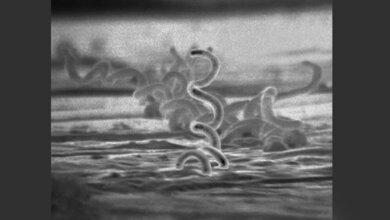 Treponema_pallidum_SEM_CDC_Dr_David_Cox.jpg Treponema pallidum